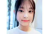 뉴진스 혜린 라미네이트 전후