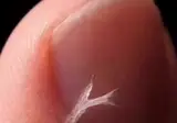 손톱 옆에 생긴 거스러미를 뜯으면 생기는 일.mp4